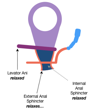 In the third and last sketch of the series, the drawstring-like Puborectalis is relaxed, the Internal Anal Sphincter is relaxed, and the External Anal Sphincter is relaxed. The result of all this relaxation is a clear and easy exit for waste material.