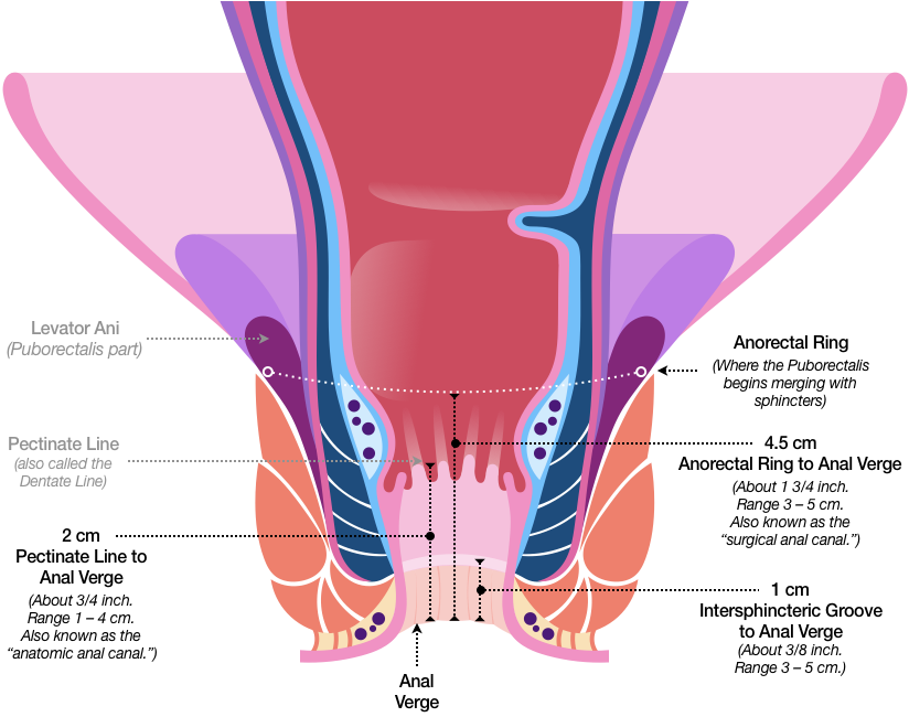 Figure 31 is the same sketch as Figure 30 but includes average lengths of various Anorectal features. The Anal Verge to Intersphincteric Groove is about 1 cm (which is about three-eighths of an inch). The Anal Verge to the Pectinate Line is about 2 cm, which is about three quarters of an inch. The Anal Verge to the Anorectal Ring, which is where the Puborectalis begins merging with the sphincters, is about 4.5 cm, or about 1 and three quarters inch.