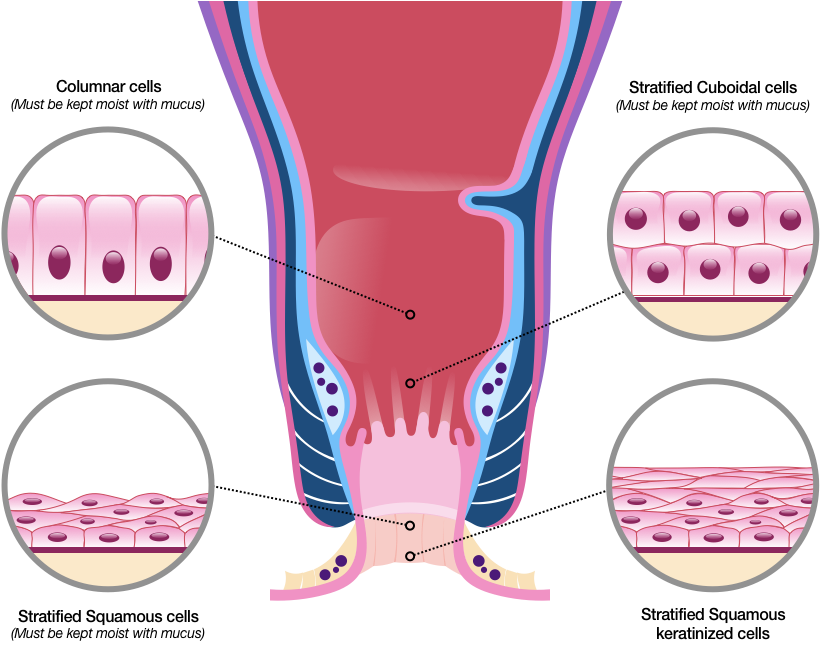 Figure 33 shows the Anorectal area as before, and includes a close-up view of four types of cells. Starting from the Rectum, Columnar cells are shown as long vertical rectangles with the shorter side that faces the lumen slightly rounded, and its opposite side connected to a base membrane. Closer to the Pectinate line are cuboidal cells, which look like rows of stacked cubes. Near the Intersphincteric Groove are stacks of squamous cells that look a little like the scales you might see on a snake or lizard. Near the anal verge are stacks of keratinized Squamous cells, which do not have a nucleus, sitting atop non-keratinized Squamous cells, which have their nuclei preserved.