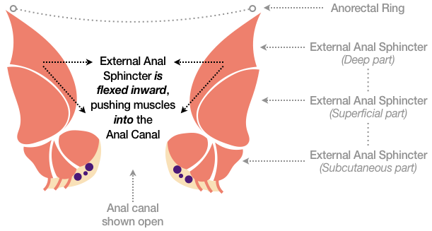 Figure 38 shows the muscles of the External Anal Sphincter flexing inward, pushing the Deep and Superficial parts into the Anal Canal and drawing the Subcutaneous part upward and inward, which may result in a pinching motion.